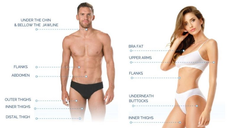 CoolSculpting treatment areas on man and woman