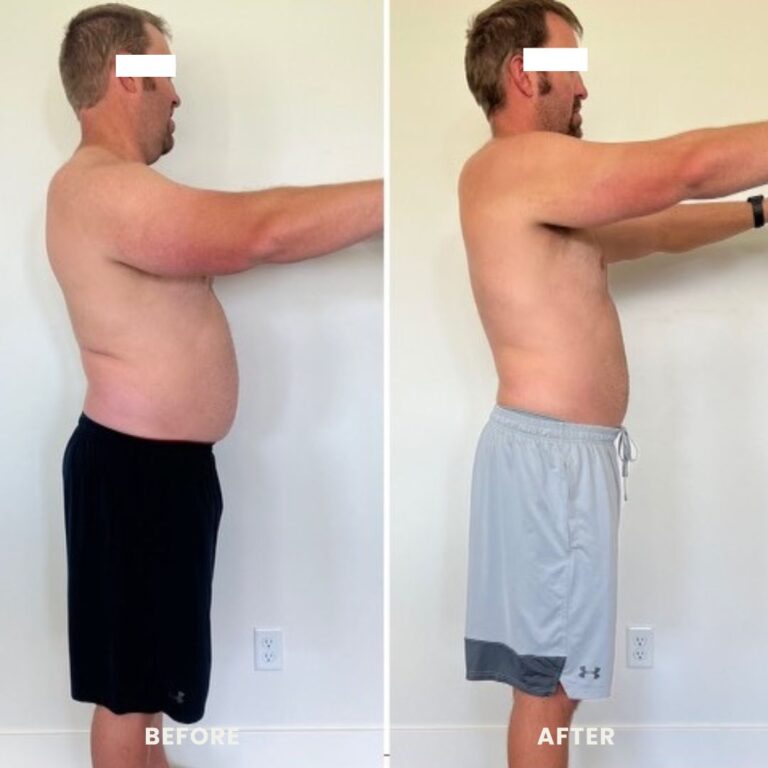 weight loss injections before and after photo of a man showing a reduction of abdominal fat.