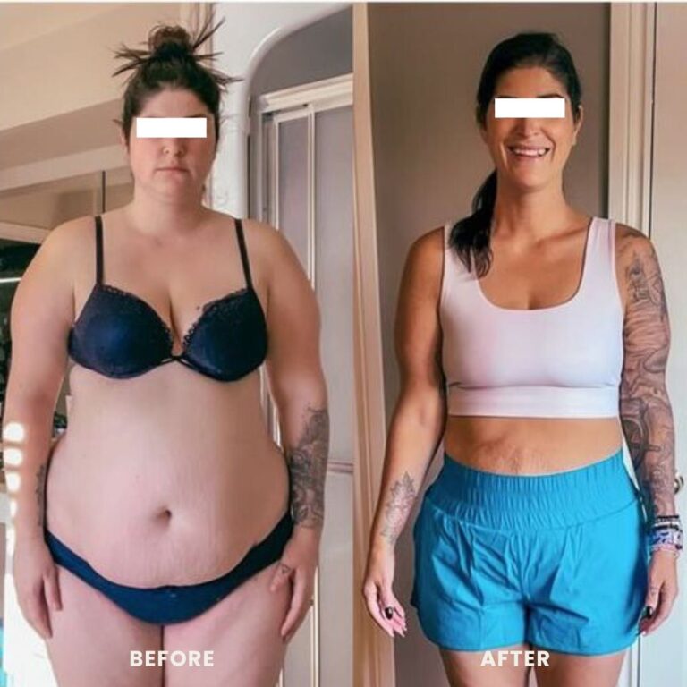 weight loss injections before and after photo of a woman showing a massive body fat reduction.