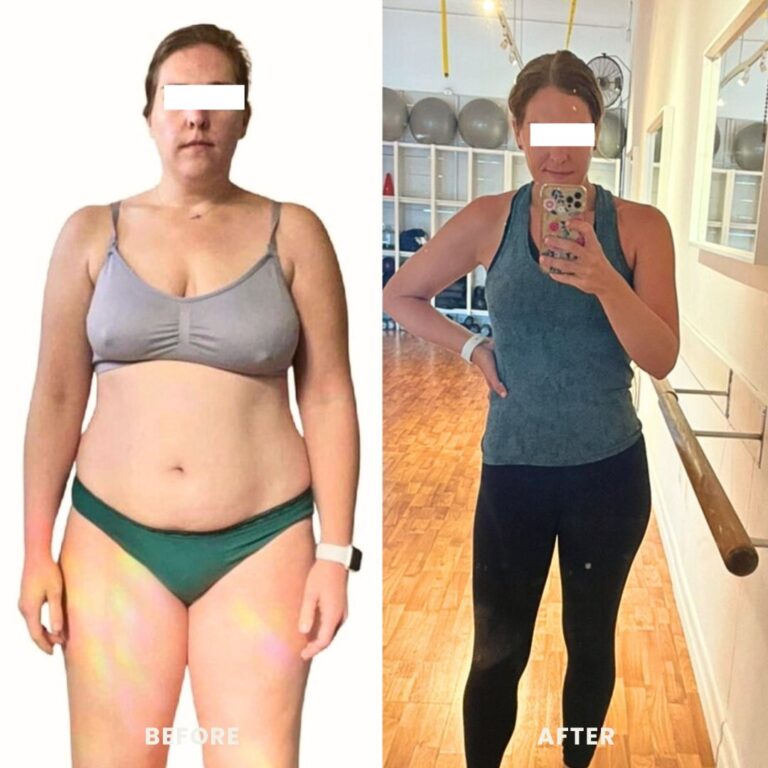 weight loss injections before and after photos of a woman showing a massive body fat reduction.