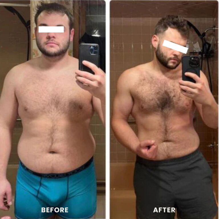 weight loss injections before and after showing a reduced abdominal fat of a man.